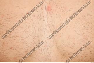 human skin hairy 0010